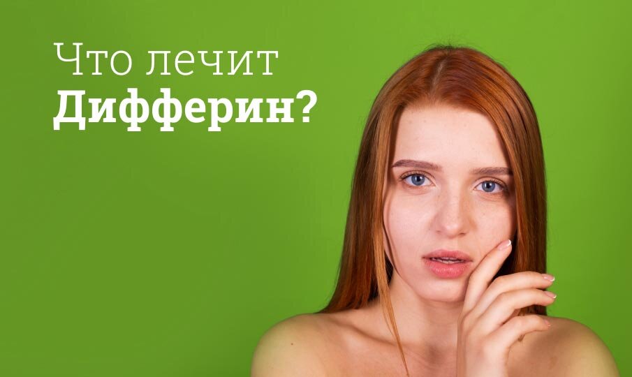 Что лечит Дифферин?