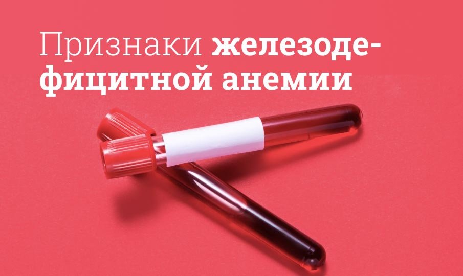 Железодефицитная анемия симптомы, лечение, причины