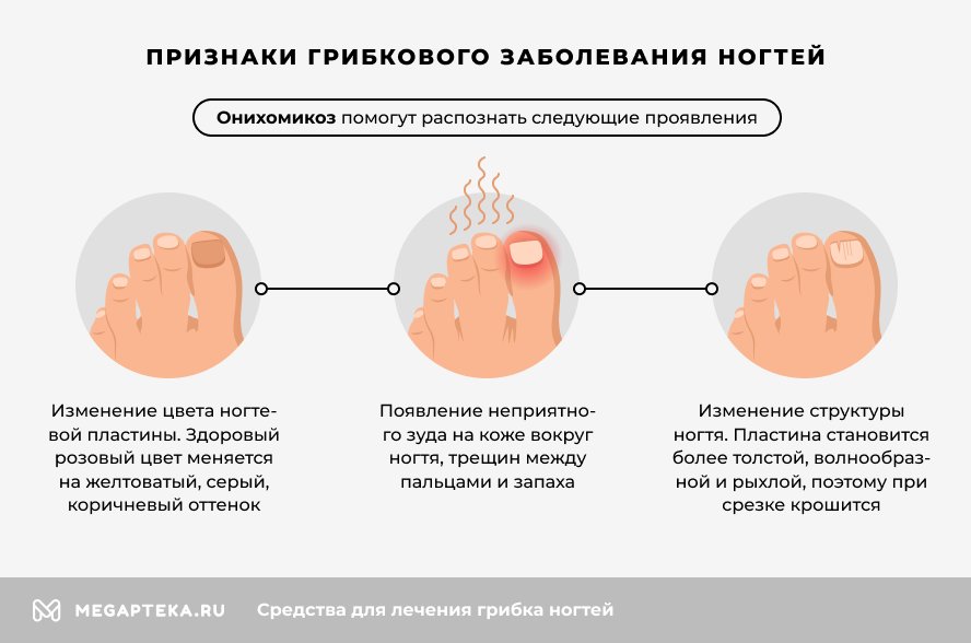 Схема лечения грибка кожи