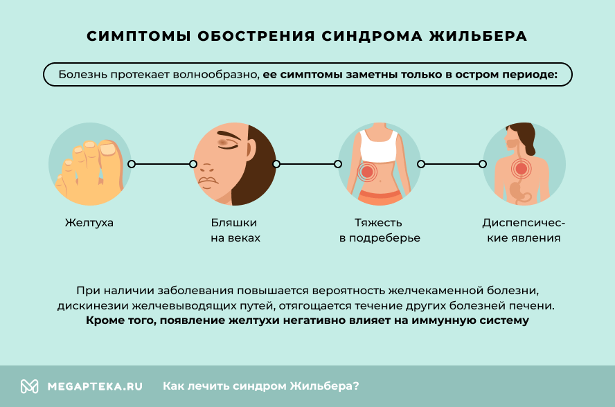 Стул при синдроме жильбера