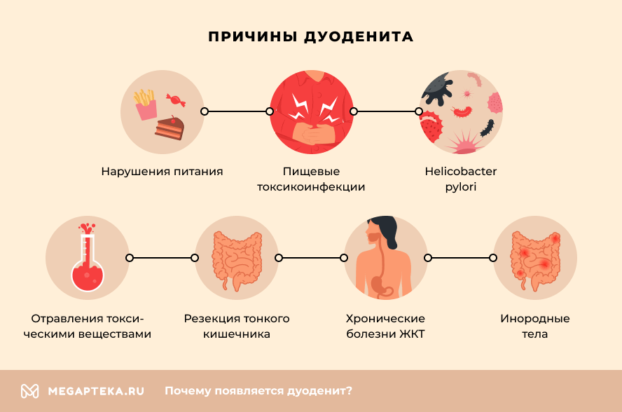 Схема лечения дуоденита