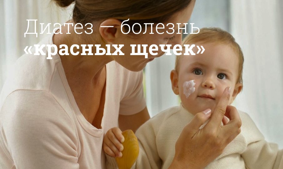 Мазь от диатеза для детей и новорожденных